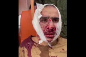 【ロシア・テロ事件】兵士が捕まえた容疑者の耳を切断、口に入れる