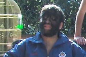 世界で最も毛深い家族に対し、「チューバッカの家族？」と心無いコメント