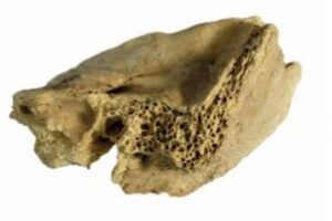 ネアンデルタール人の子供にダウン症の痕跡、遺伝的疾患の最古の例