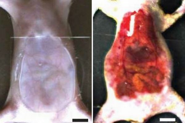 食用色素により、マウスの皮膚や筋肉などを一時的に透明にさせることに成功