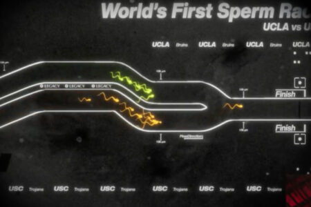 精子が泳ぐ速さを競う「精子レース」L.A.で開催、ライブ動画がまるでF1グランプリ