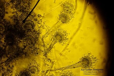 気候変動の影響により、有害な真菌による感染リスクが高まる可能性
