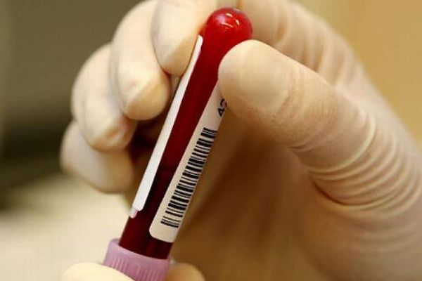 新たな血液型「グワダ陰性」を特定、確認されたのは世界でただ1人の女性のみ