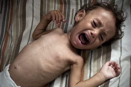 国連のIPCが新たな報告、ガザ地区で13万2000人の子供が急性栄養失調