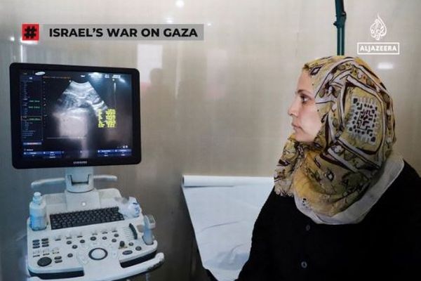 国連、イスラエル軍がガザ地区で「医療虐殺」を行っていると非難