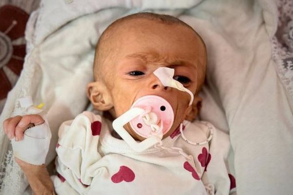 イスラエル軍の攻撃によりガザ地区で71人が死亡、2人の子供を含む3人が餓死