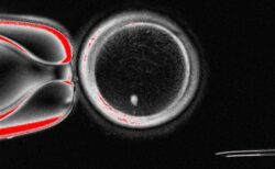 不妊治療に革命か？科学者らが人間の皮膚細胞から卵子を作成