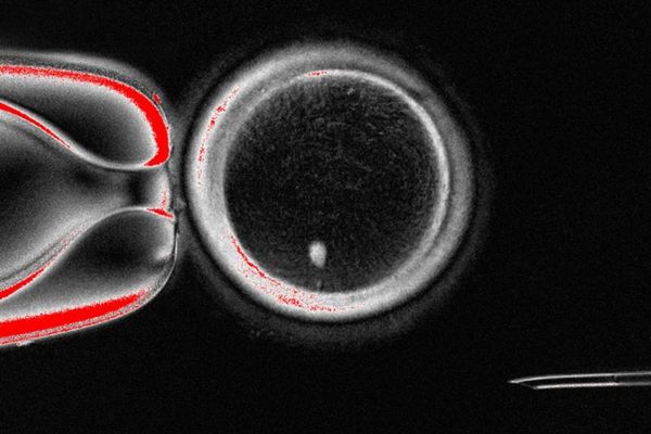 不妊治療に革命か？科学者らが人間の皮膚細胞から卵子を作成