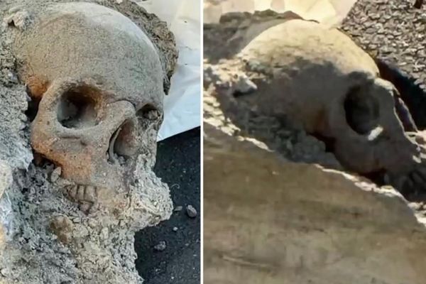 港で作業員が、コンクリートに埋もれた人間の頭蓋骨らしきものを発見