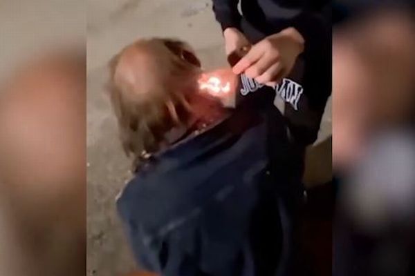 若者2人が、ホームレスの男性の髪に火をつける【スペイン】