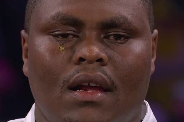 ダーツの世界大会で、ケニア人選手の顔にハチがとまる【動画】