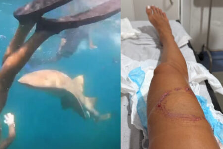 サメに襲われたシュノーケリング女性、噛まれる瞬間が撮影されていた