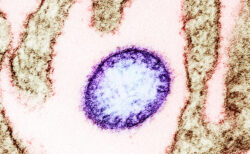 ワクチンも治療法もないニパウイルス感染症が、インドで大流行の兆し