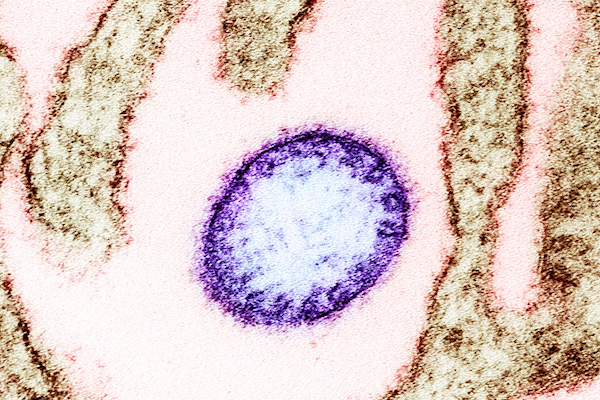 ワクチンも治療法もないニパウイルス感染症が、インドで大流行の兆し