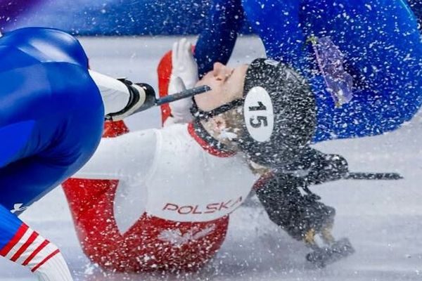 【五輪】ショートトラックの女子選手、ブレードで目の上を負傷