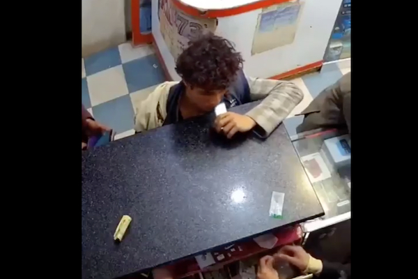 スマホバッテリーを齧った少年、口の中で爆発する動画が恐ろしい