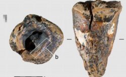 ネアンデルタール人、石製のドリルを使って虫歯を治療