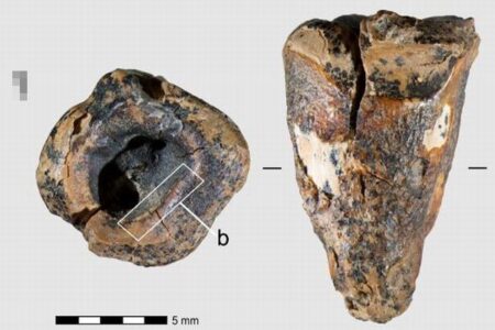 ネアンデルタール人、石製のドリルを使って虫歯を治療