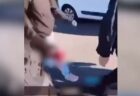 フランスでの抗議デモ、15歳の少年の手が吹き飛ばされる