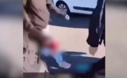 フランスでの抗議デモ、15歳の少年の手が吹き飛ばされる