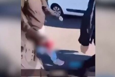 フランスでの抗議デモ、15歳の少年の手が吹き飛ばされる